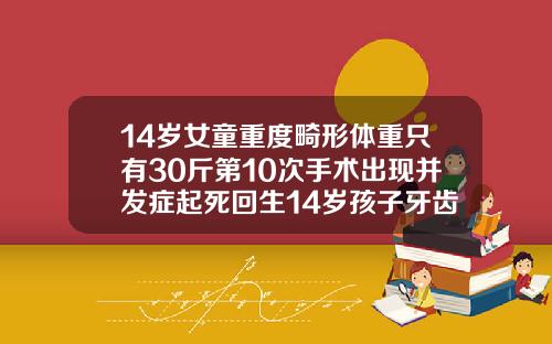 14岁女童重度畸形体重只有30斤第10次手术出现并发症起死回生14岁孩子牙齿矫正会不会影响发育